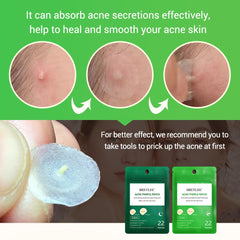 BREYLEE Acne Pimple Patches